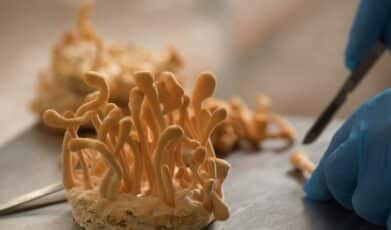 סובלים ממערכת חיסונית חלשה? 5 דרכים לחזק אותה בצורה טבעית